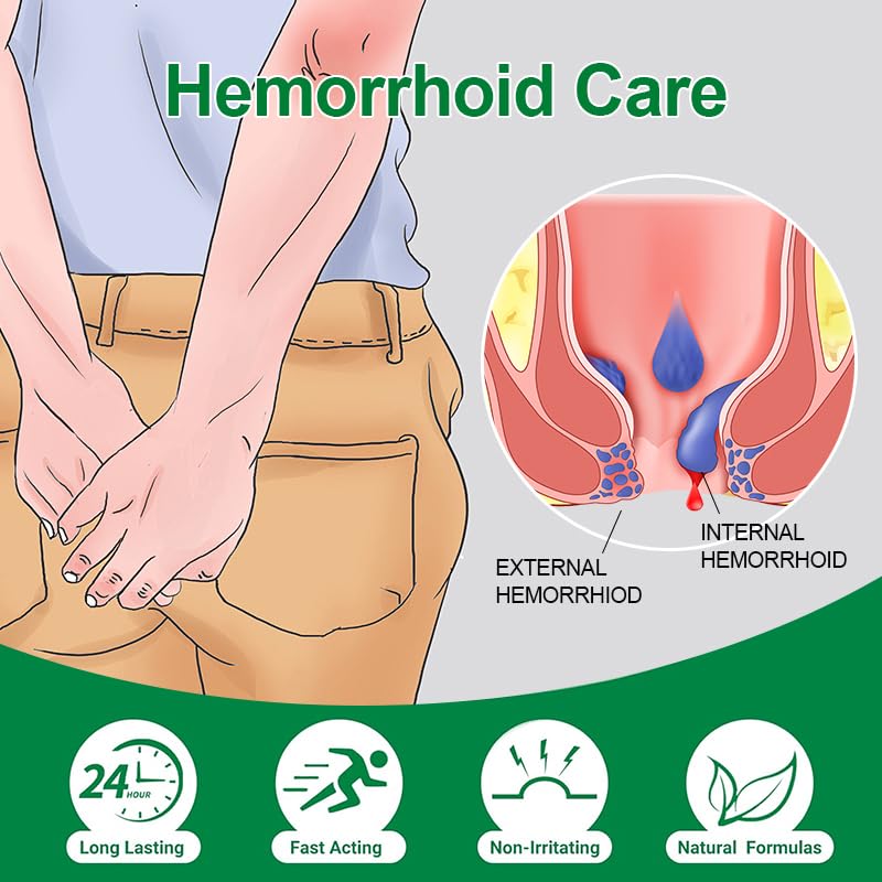 vamy Hemorrhoid Ointment (2 x 20g Tubes), 40g - Maximum Strength Formula for Hemorrhoidal Fast Relief, Soothes Itching, Burning & Discomfort - TrustMedUSA