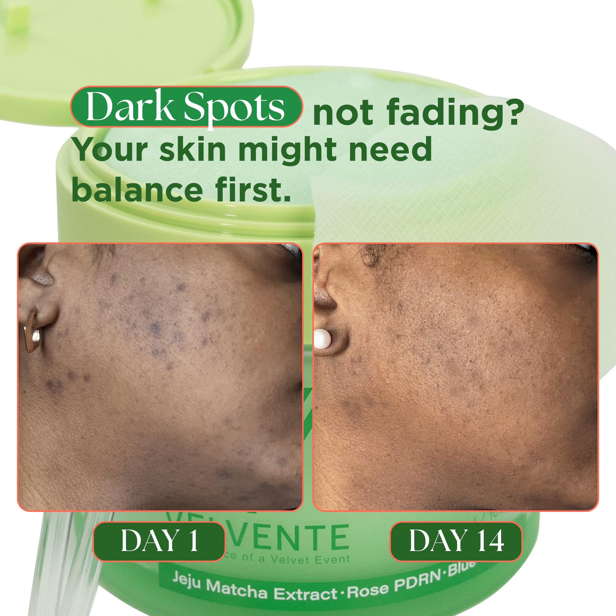 VELVENTE Matcha Gentle Deep Pore Cleansing Facial Cleanser, Low-pH Face Wash for Pore Refining, Rose PDRN Hydrating Daily Facial Wash Redness & Sensitive Skin Friendly, Korean Skincare(5.07 fl.oz.) - Maple Wellness Supplements