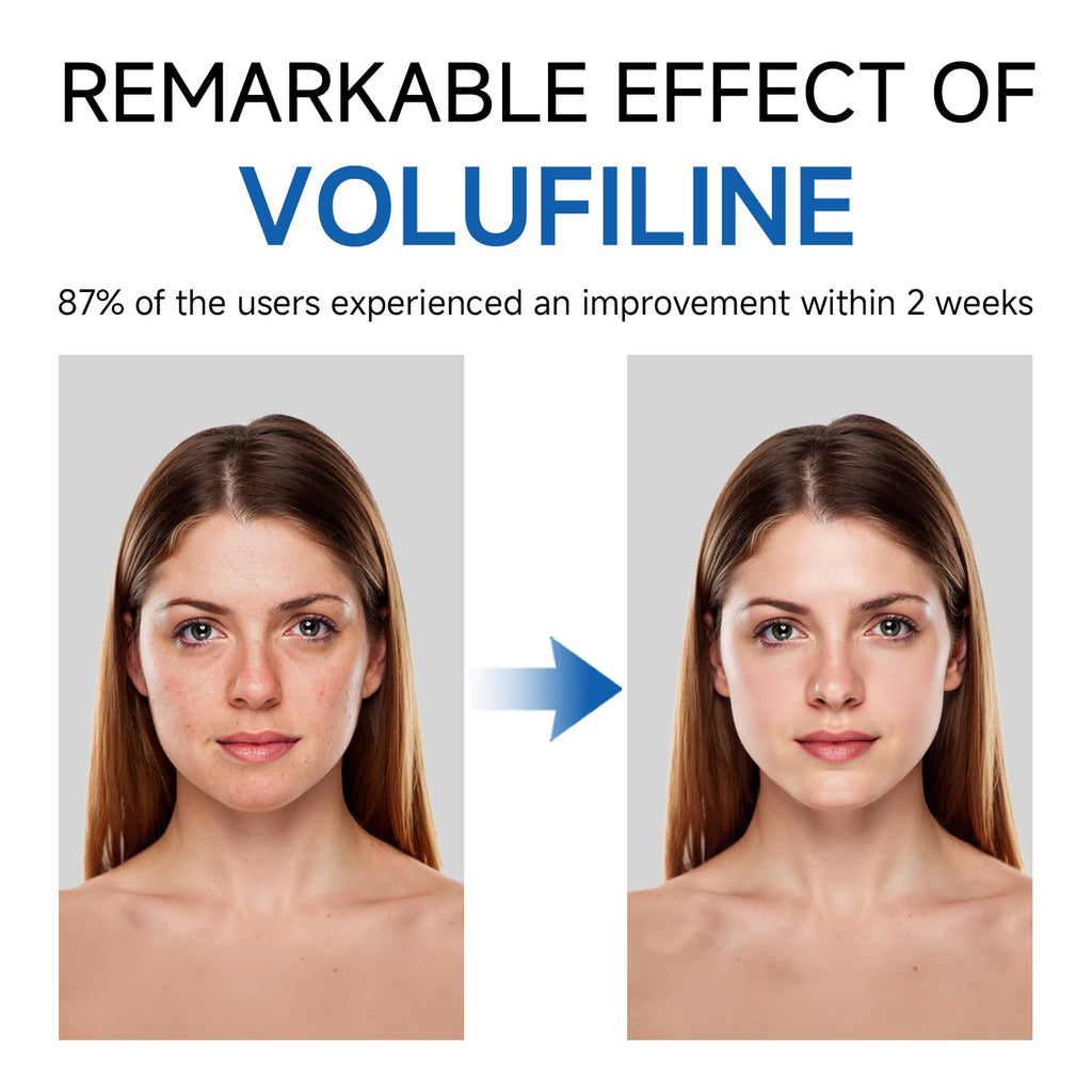 Volufiline Serum, Volufiline Under Eye Serum, Cosmetic Grade Ampoule for Skin Elasticity Improvement, Face & Body Fine Lines, Hydrating Texture, 10ml*2 - TrustMedUSA
