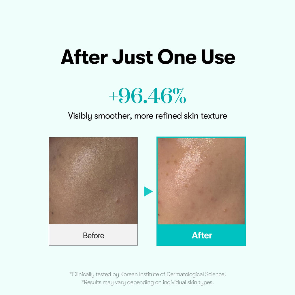 VT COSMETICS PDRN Glow Ampoule, PDRN Facial Mist, Deep Hydration Spray Serum, Vegan Skin Care, Light-weight Face Moisturizer, Plumping Effect, Fragrance-Free, Korean SkinCare (3.38 fl oz / 100 ml) - TrustMedUSA