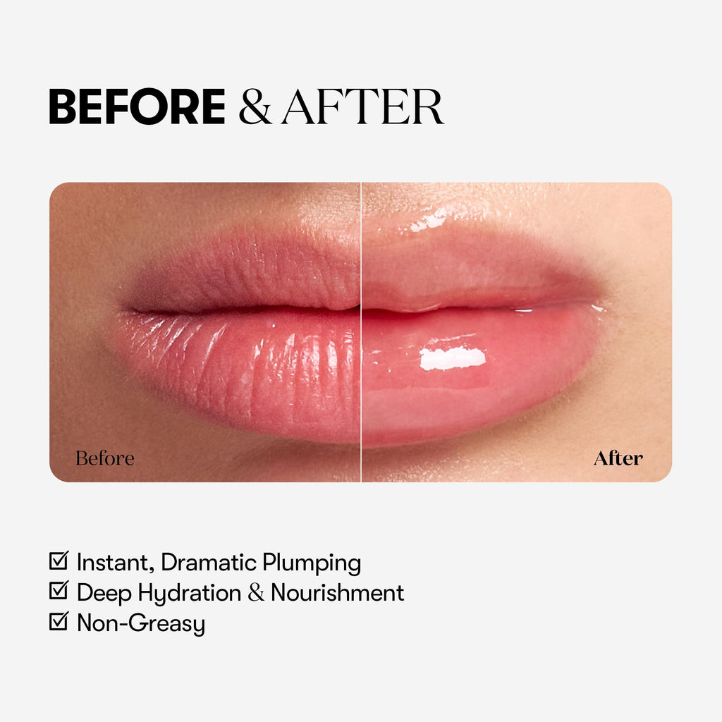 VTCOSMETICS Reedle Shot Lip Plumper, 0.15 oz (4.3 g), Moisturizing, Transparent, Lip Gloss, Fragrance-free, Korean Cosmetics (Expert) - TrustMedUSA
