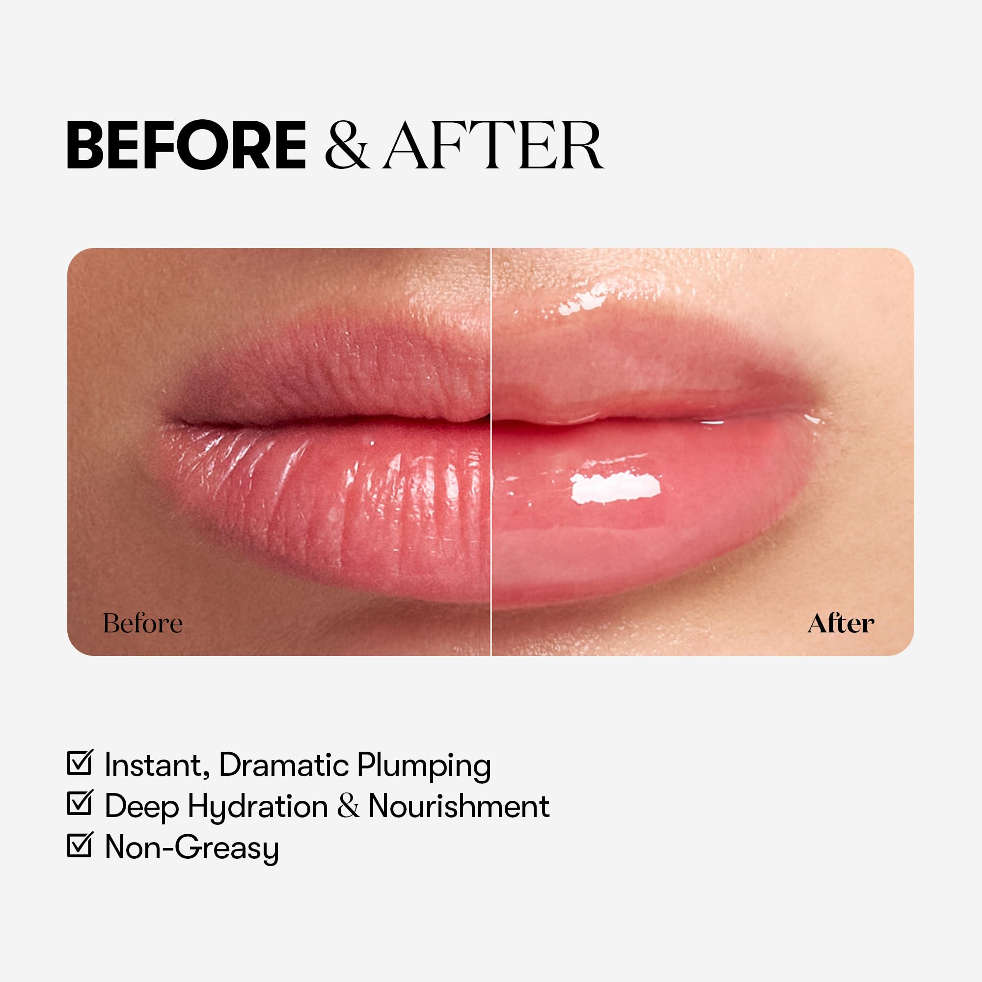 VTCOSMETICS Reedle Shot Lip Plumper, 0.15 oz (4.3 g), Moisturizing, Transparent, Lip Gloss, Fragrance-free, Korean Cosmetics (Expert) - TrustMedUSA