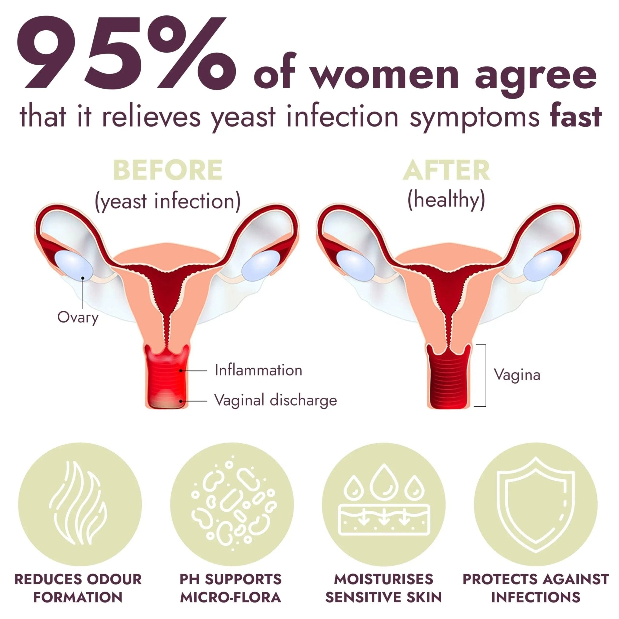 Yeast Infection Treatment for Women | Boric Acid Suppositories For Women | Helps Relieve Itching & Irritation | Vaginal Aid for Inflammation, Dryness & Watery Discharge | 12 Vaginal Suppositories - TrustMedUSA