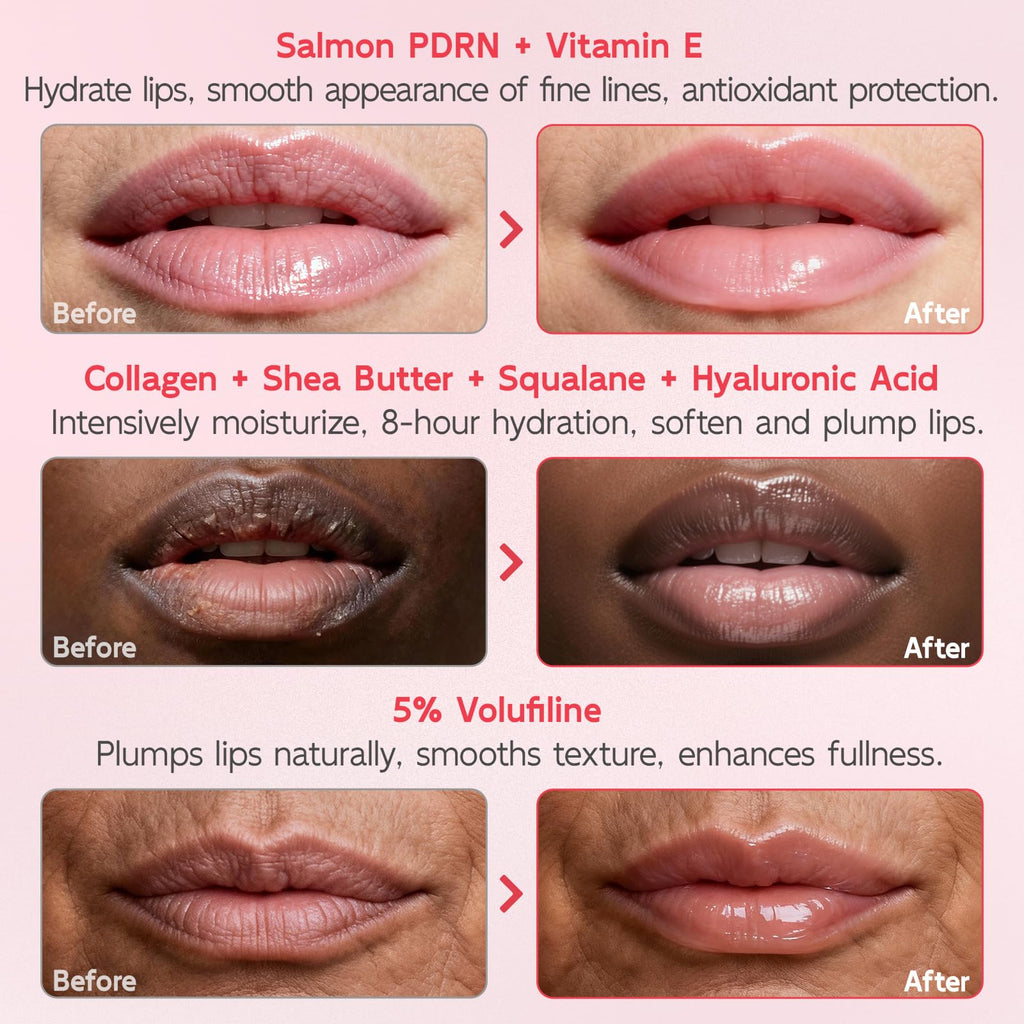 YouthVibe Lip Mask Overnight Moisturizing - Nourish & Hydrate, Antioxidants, 5% Volufiline - TrustMedUSA