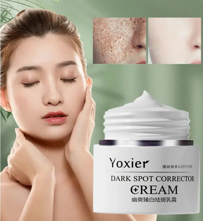 Yoxier Face Cream Dark Spot Corrector Anti-Aging Whitening - TrustMedUSA