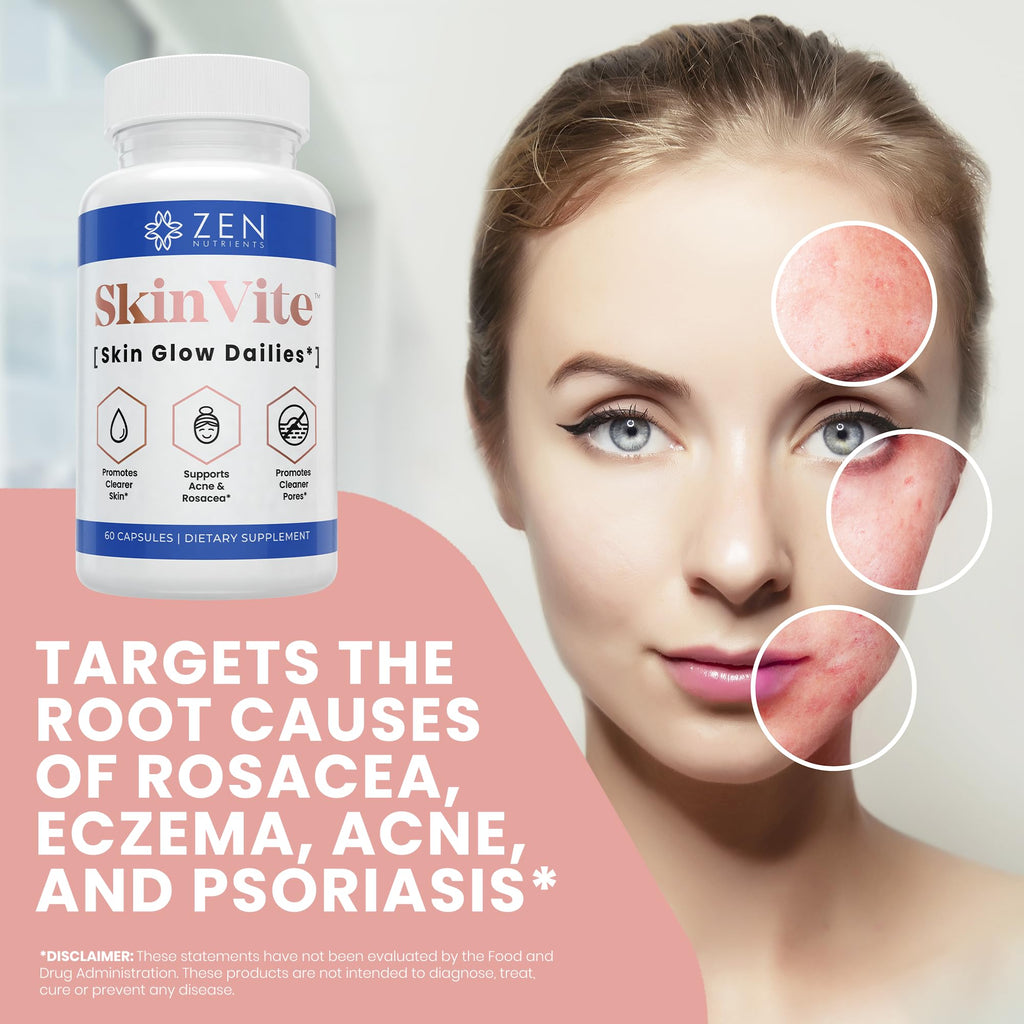 Zen Nutrients SkinVite Natural Skin Supplement for Women, Men & Teens - Hormonal Breakouts & Clear Skin Support Supplement - Detoxifying Vitamin for Acne and Digestion Support - TrustMedUSA