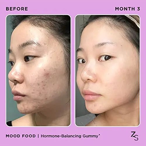 ZitSticka Mood Food: Gummy for Moody Skin + PMS Drama, Forest Berry Flavour - TrustMedUSA