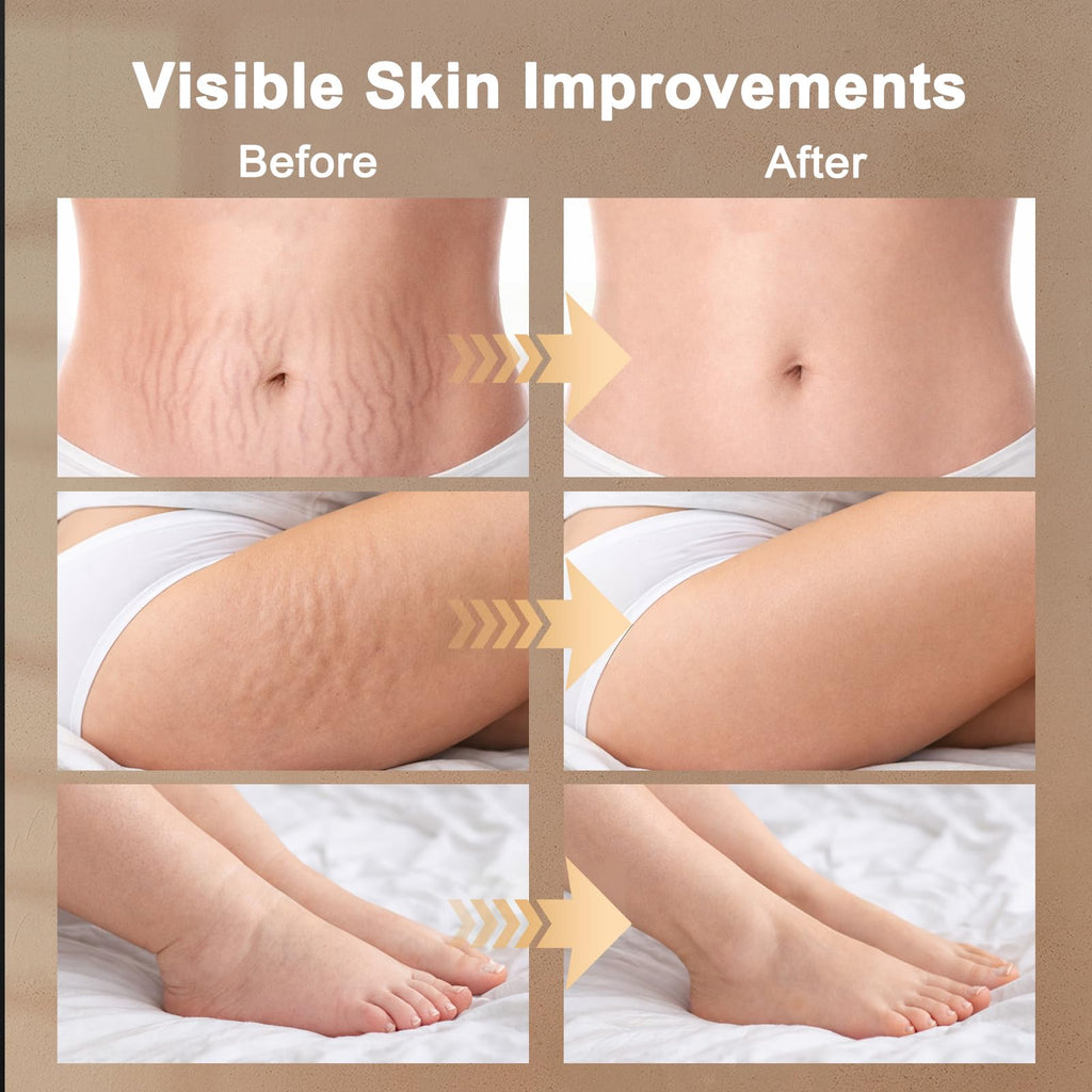 ZRCZRC Lymphatic Drainage Massager, Lymphatic Massager, Helps Reduce Stretch Marks & Cellulite, for Legs, Arms & Belly, Body Sculpting Machine with Microcurrent, Light, Heat & Vibration, White - Maple Wellness Supplements